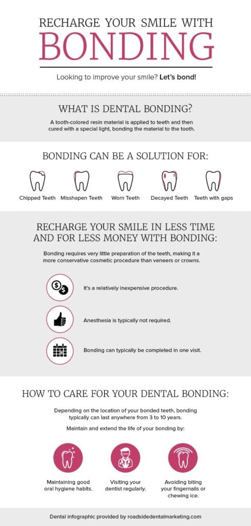 Dental infographic - Recharge your smile with dental bonding!